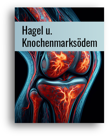 Hagel u. Knochenmarksödem